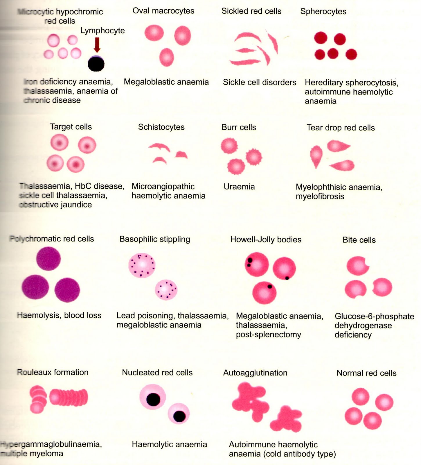 Abnormal Red Blood Cells Images