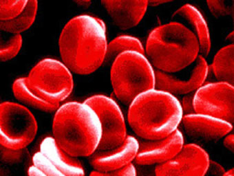 Abnormal Red Blood Cells Images