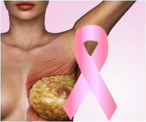 Best Breast Cancer Treatment Centers In India