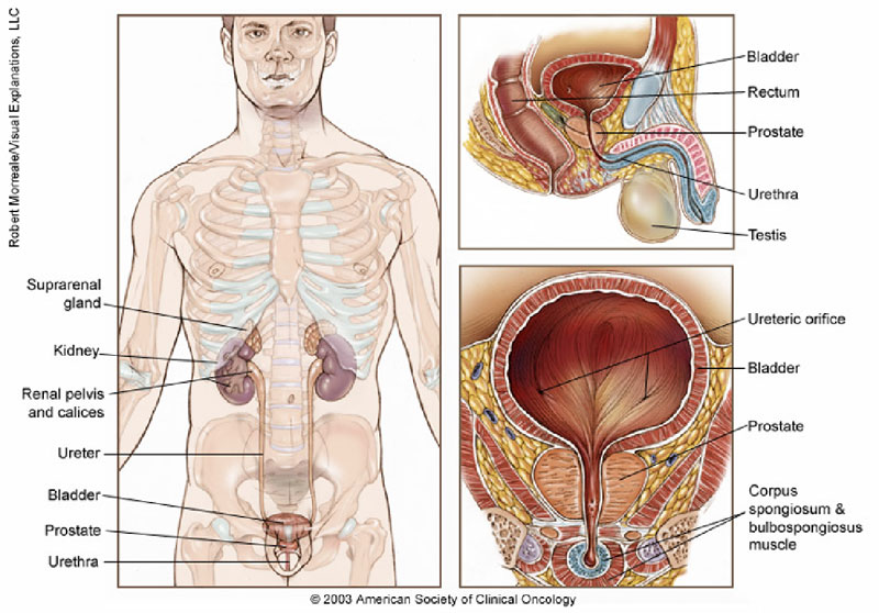 Bladder Cancer Treatment