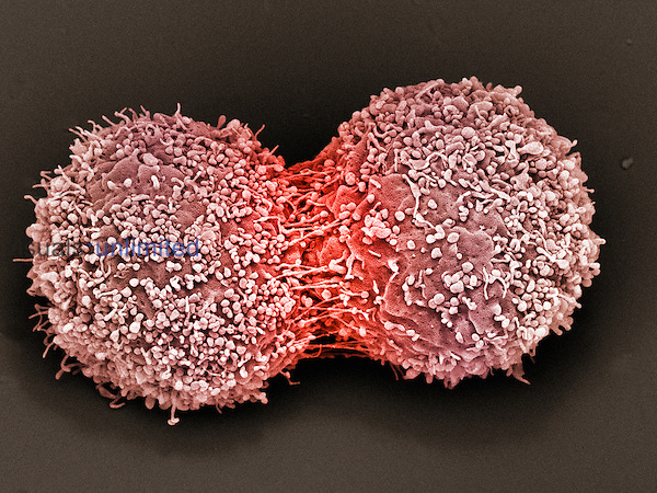Breast Cancer Cells Dividing