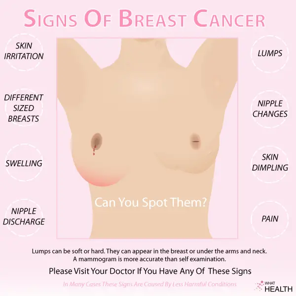 Breast Cancer Signs And Symptoms Pain
