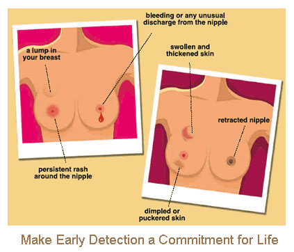 Breast Cancer Symptoms Images