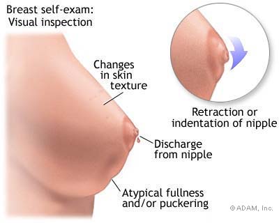 Breast Cancer Symptoms In Men Pictures