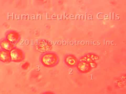 Cancer Cells Dividing Video