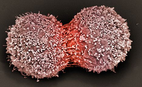 Cancer Cells Dividing Video