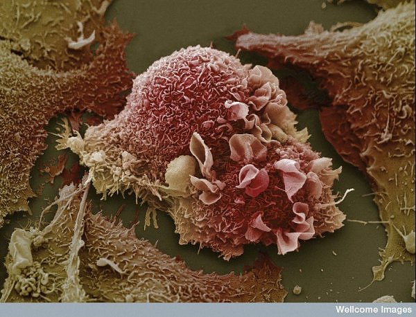 Cancer Cells Images
