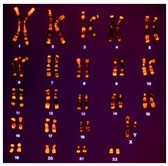 Cancer Cells Vs Normal Cells Karyotype