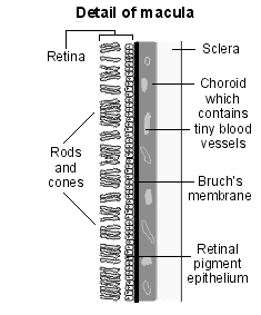 Cellophane Maculopathy Symptoms