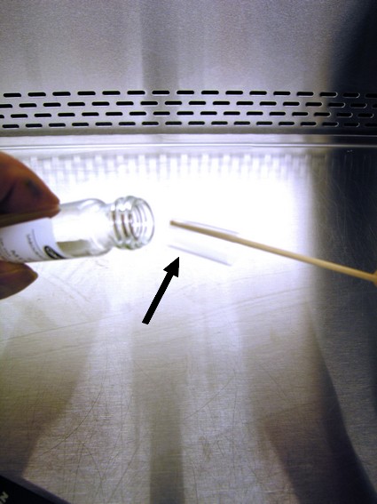 Cellophane Tape Test For Pinworms