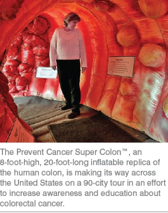 Colon Cancer Symptoms In Men Mayo
