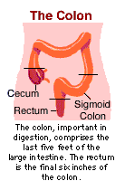 Colon Cancer Symptoms In Men Signs