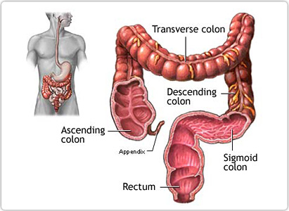 Colon Cancer Symptoms Stages