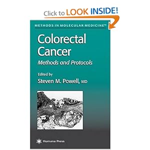 Colon Cancer Treatment Protocols