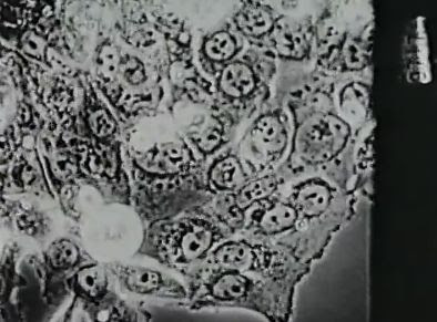 Hela Cell Division Video