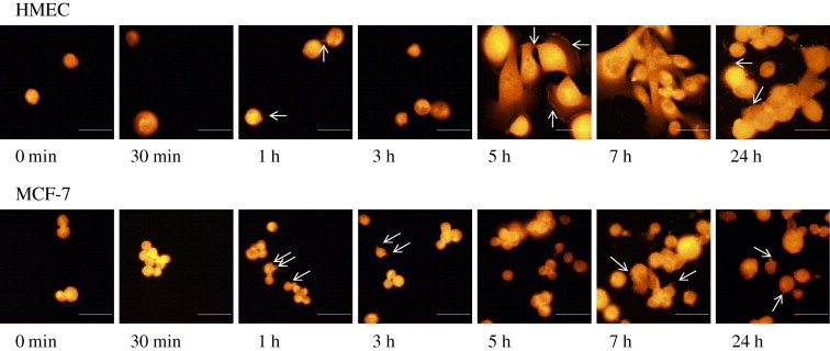 How Are Cancer Cells And Normal Cells Different