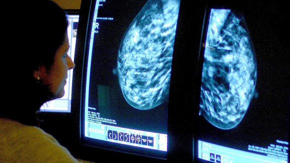 How Much Breast Cancer Treatment Cost