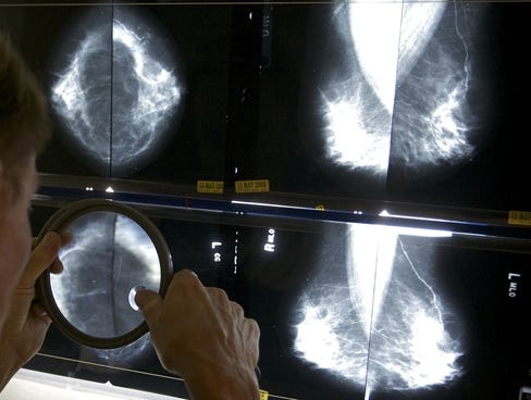 How Much Breast Cancer Treatment Cost