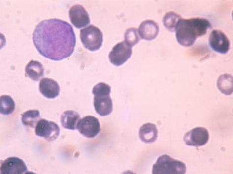Immature White Blood Cells Images