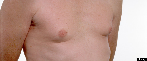 Male Breast Cancer Symptoms And Signs