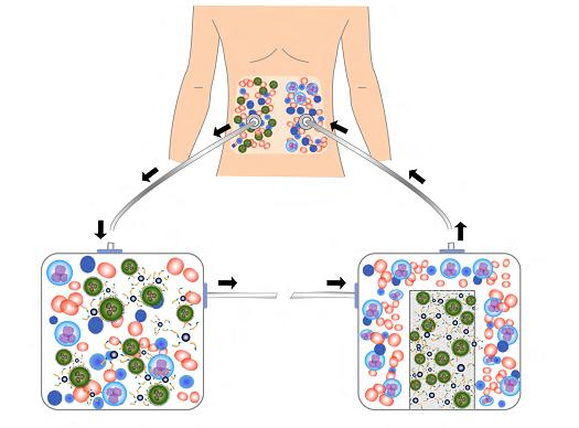 Nanotechnology In Cancer Treatment Wikipedia