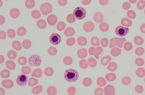 Nucleated Red Blood Cells Images