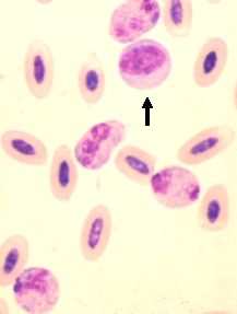 Nucleated Red Blood Cells Images