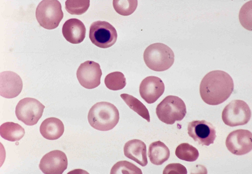 Nucleated Red Blood Cells Images