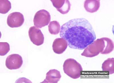 Nucleated Red Blood Cells Images