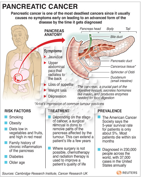 Pancreatic Cancer Symptoms Causes