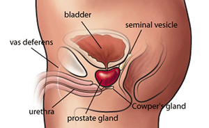 Prostate Cancer Symptoms