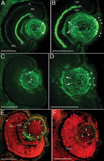 The Fiber Cells Of Plants Are A Type Of