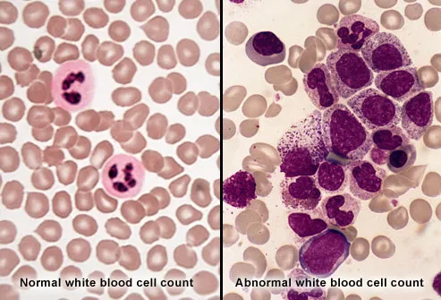 White Blood Cells For Kids